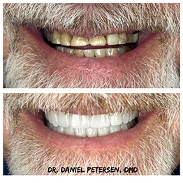 Before and after smile at Singing River Dentistry