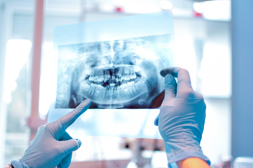 Dentist holding xray